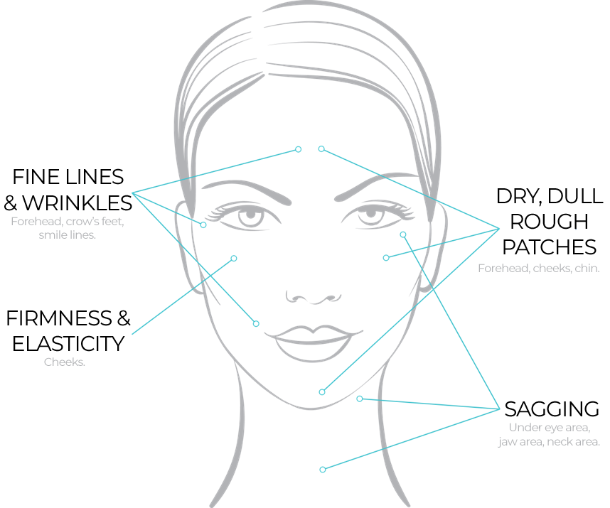 NeoCutis formula benefits
