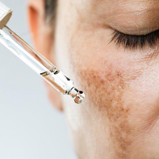 Professional Skin Treatments Professional Skin Treatments