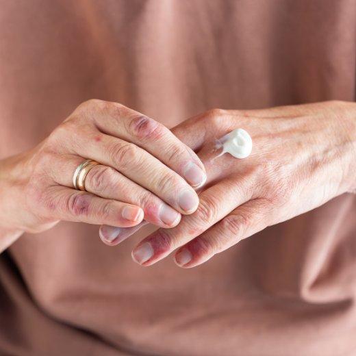 eczema-friendly skincare products