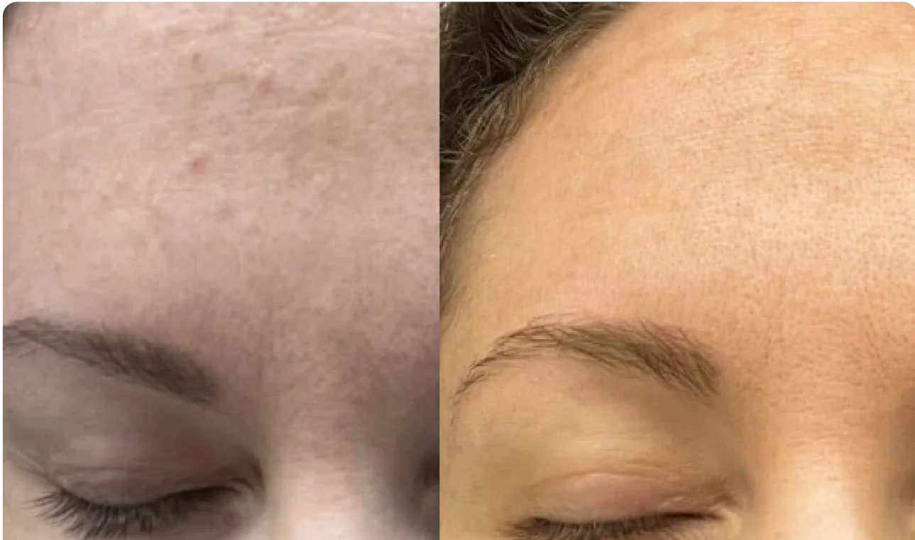 Skin Health's New Wave: Brands to Know This Year