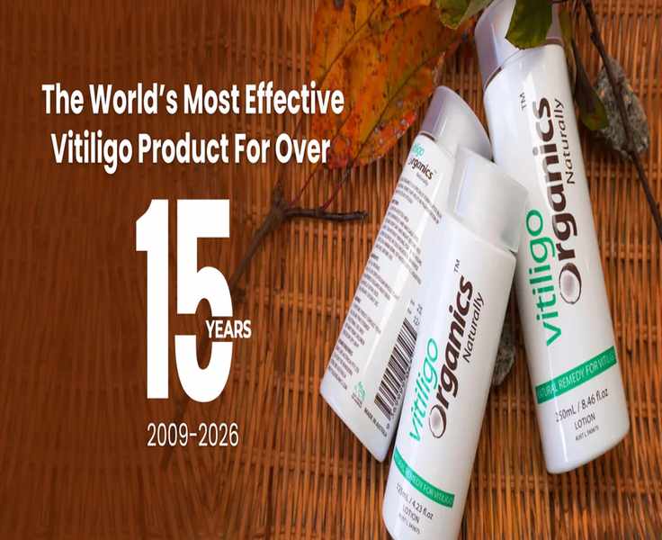 Vitiligo Organics 2026: A Buyer's Reality Check